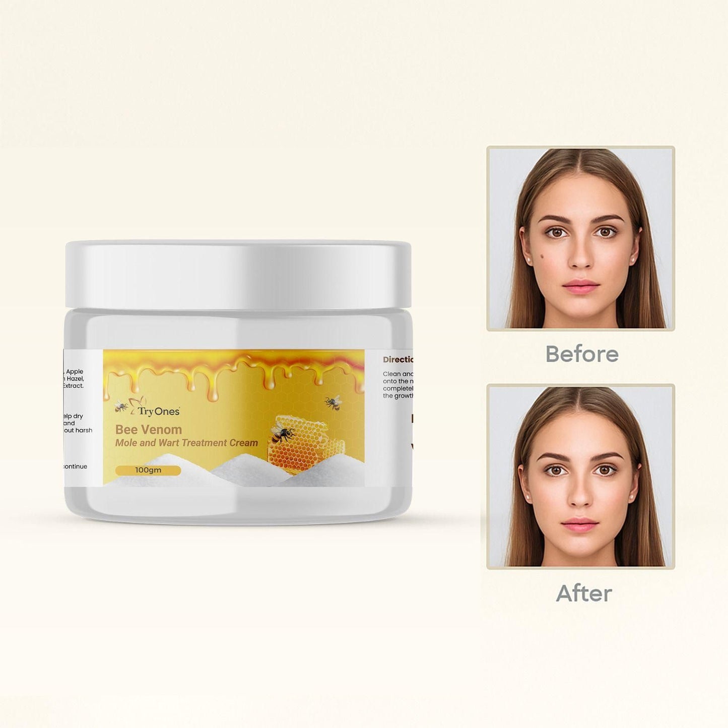 Bee Venom Wart & Mole Removal Cream β 200g x 2 (Pack of 2)